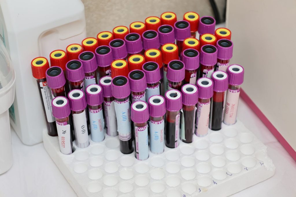Medical sample cup and testing vials on a clinic desk with a clipboard, representing a drug screening